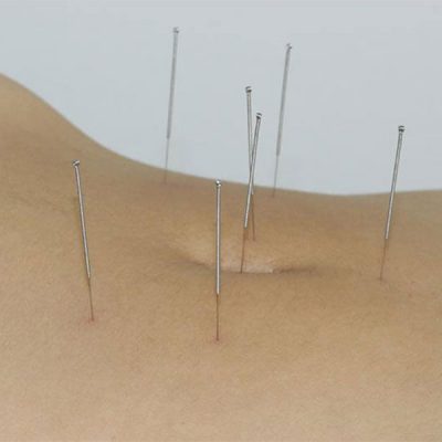 Comprar Acupuntura Abdominal Online (Tortuga Celestial)